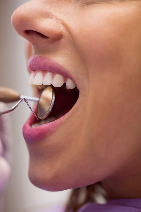 Dental checkup and oral examination by dentist for healthy teeth and gums in Indore