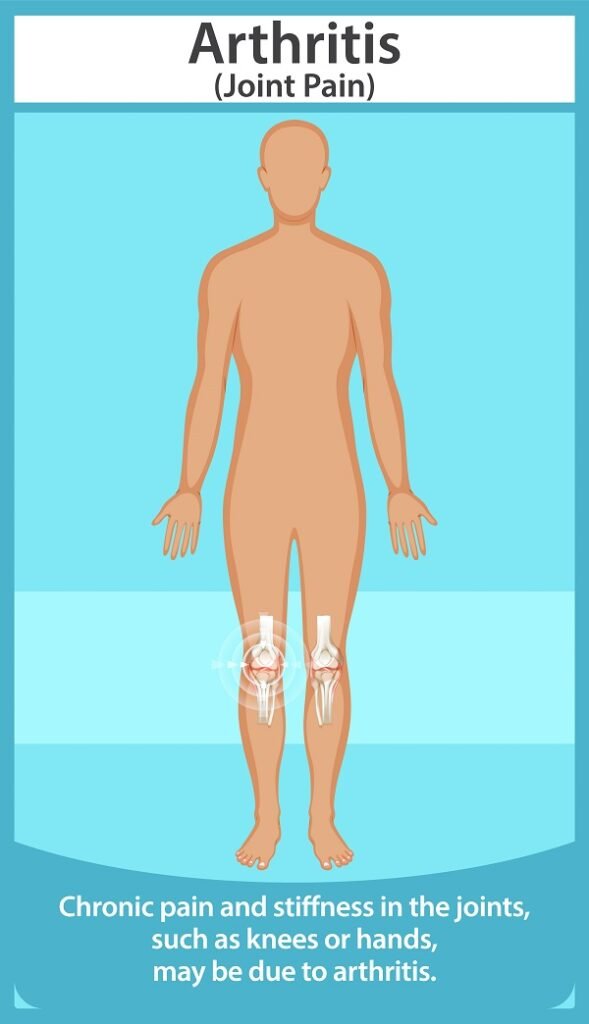 Arthritis joint pain illustration showing knee joint pain and stiffness in human body