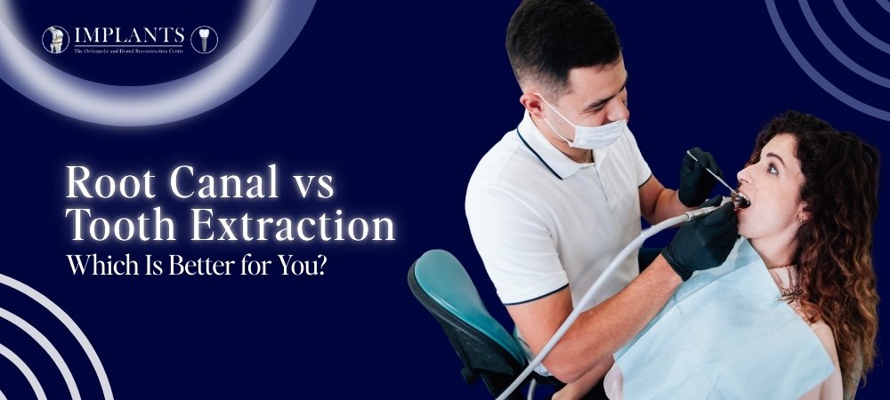 Root Canal vs Tooth Extraction: Which Is Better for You?