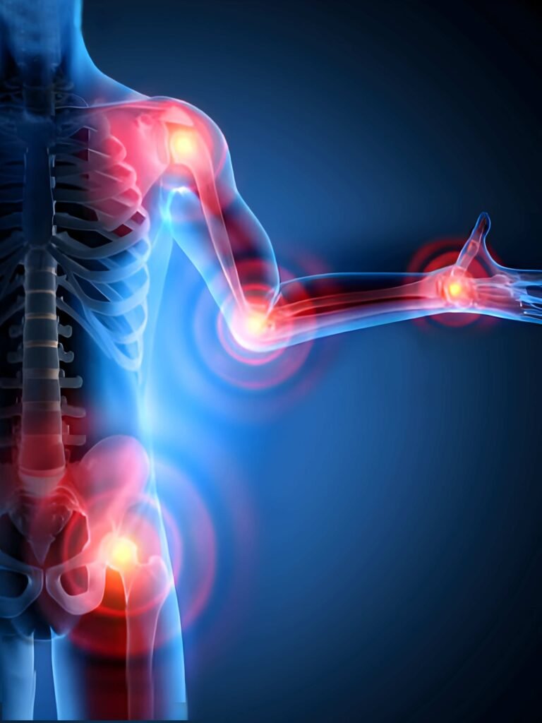 Inflamed joints in shoulder, elbow, wrist, and hip due to rheumatologic condition