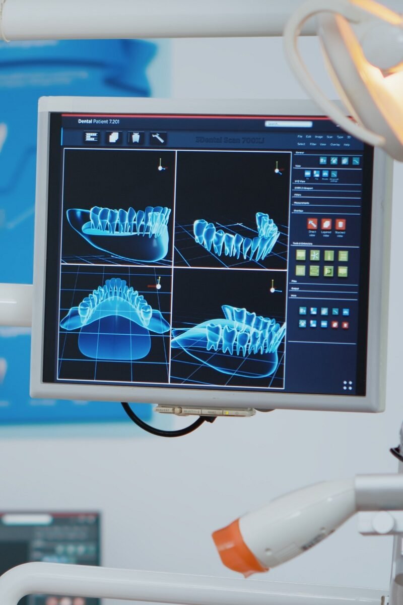 Digital smile designing using advanced dental software for perfect smile planning