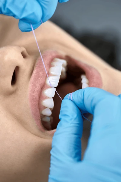 Dentist flossing patient teeth during dental cleaning and oral hygiene treatment