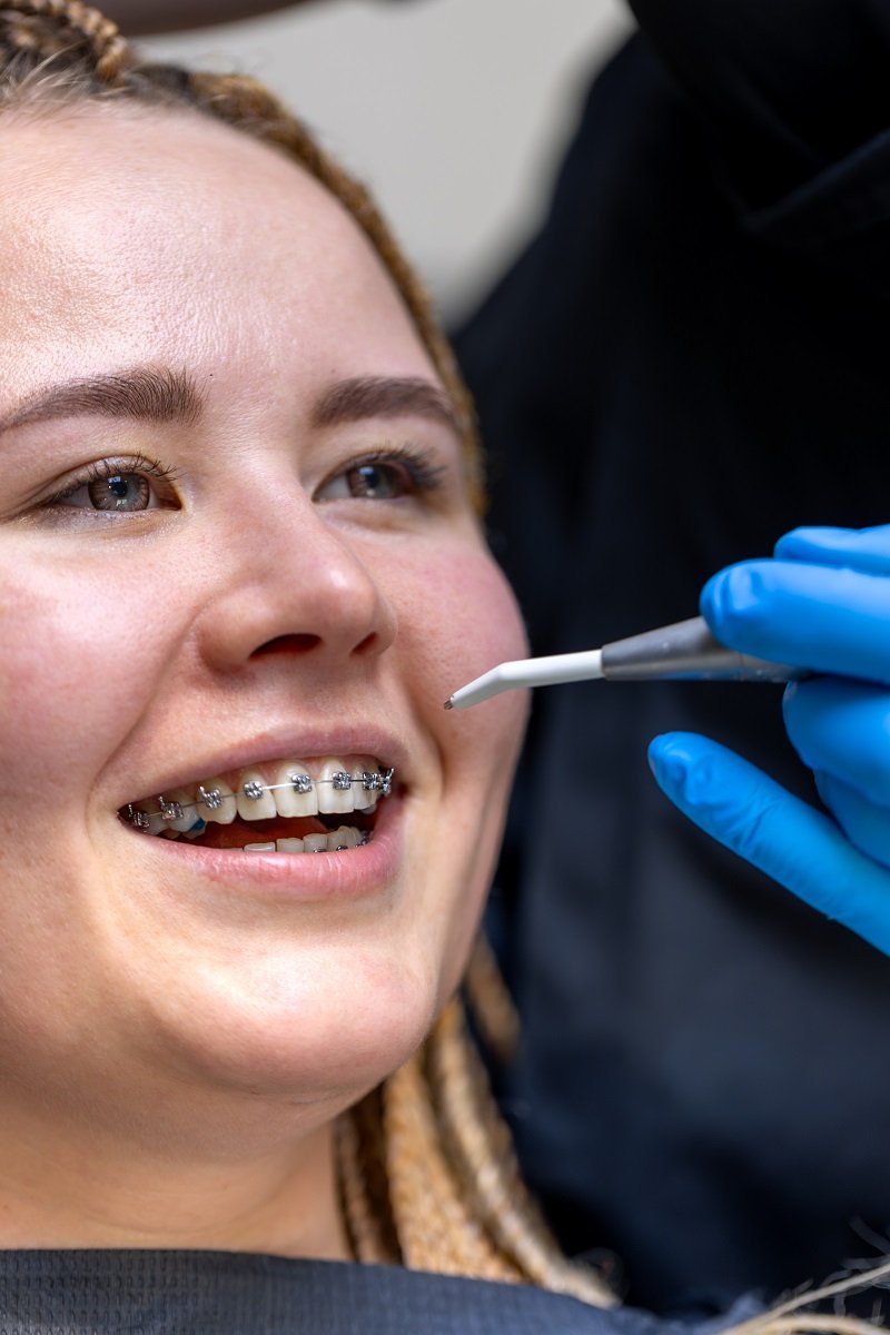 Patient with dental braces undergoing orthodontic treatment at a professional dental clinic