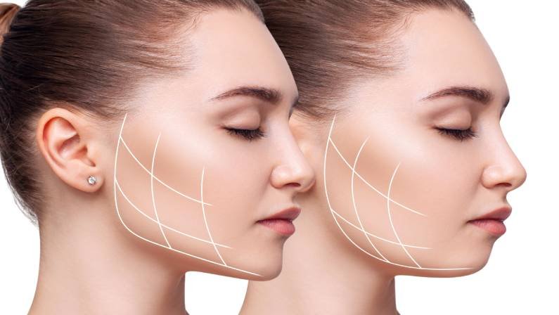 Jaw correction and facial contouring treatment for improved profile and symmetry