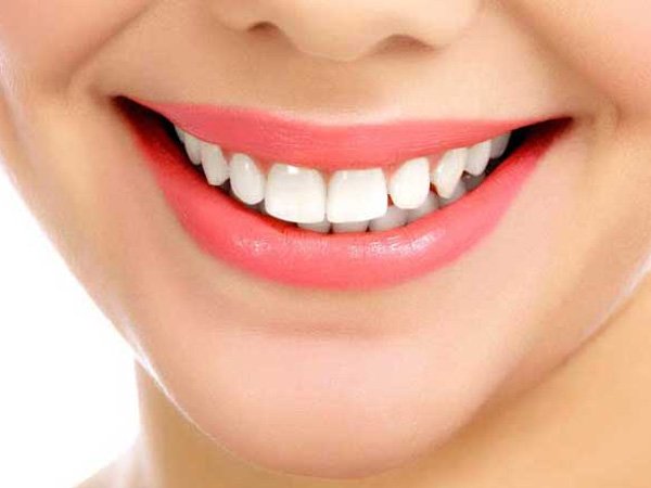 Beautiful white teeth smile after cosmetic dental treatment and teeth whitening
