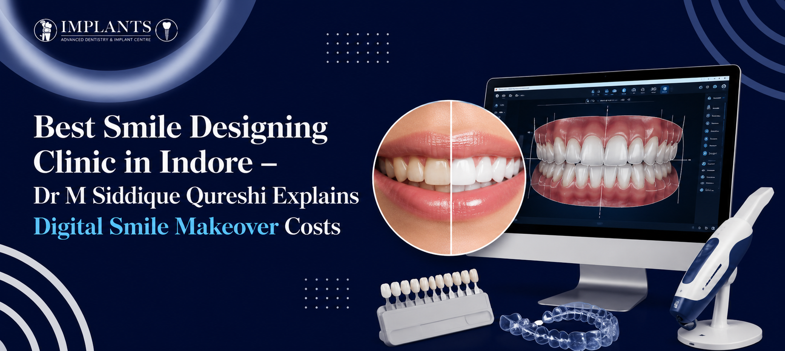 Best Smile Designing Clinic in Indore – Dr M Siddique Qureshi Explains Digital Smile Makeover Costs