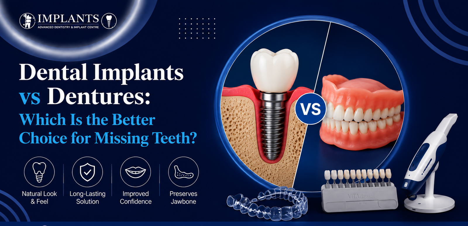 Dental Implants vs Dentures: Which Is the Better Choice for Missing Teeth?