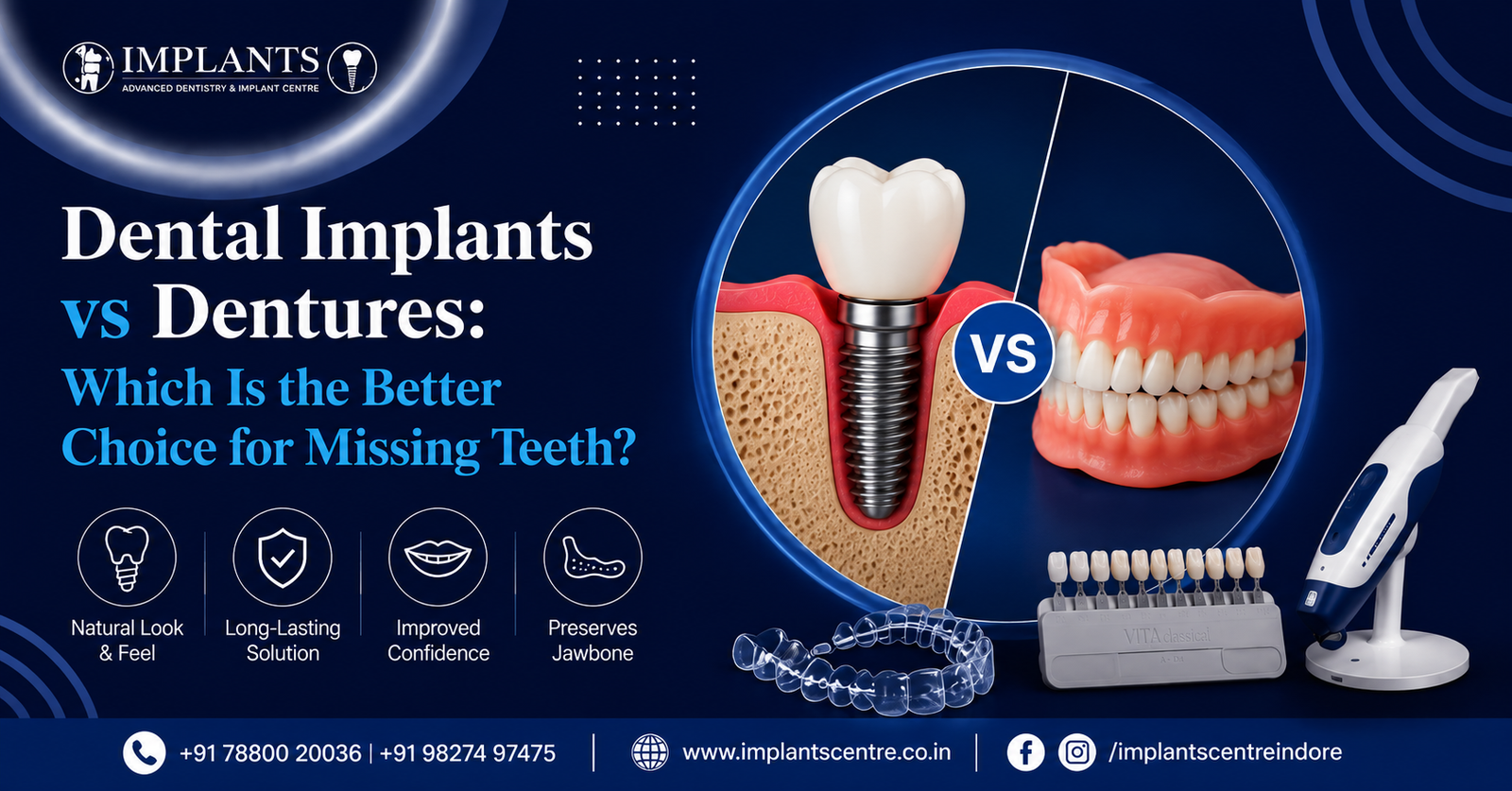 Dental Implants vs Dentures: Which Is the Better Choice for Missing Teeth?