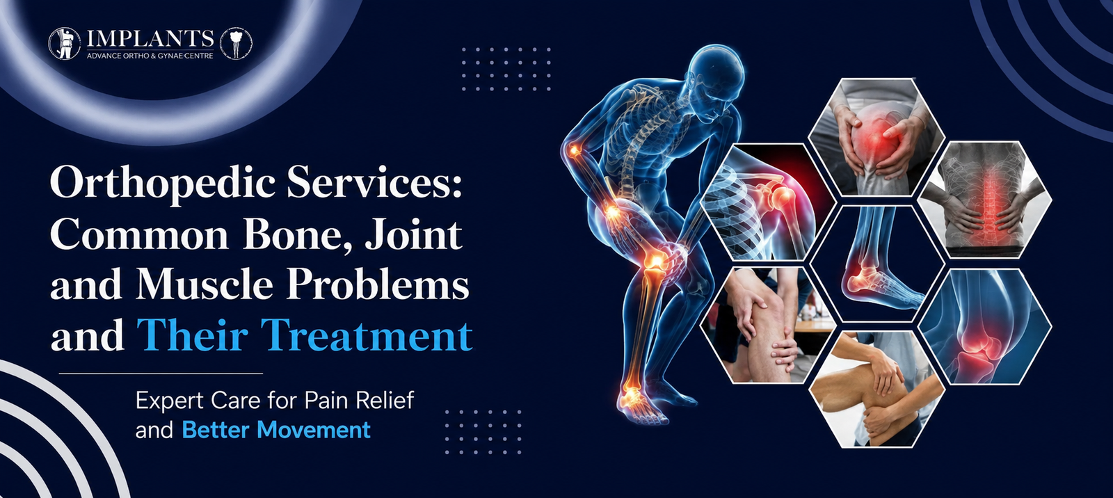Orthopedic Services: Common Bone, Joint and Muscle Problems and Their Treatment